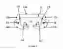 Fig. 03 - Sternal closure and ribs approximator devices