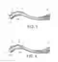 Fig. 03 - CLAVICLE REAMER