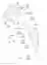 Fig. 04 - Device for extraction of prosthetic implants