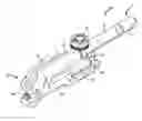Fig. 01 - Pneumatic surgical instrument and corresponding methods for implanting, extracting and reorienting orthopedic implants