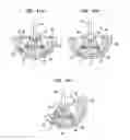 Fig. 10 - Pneumatic surgical instrument and corresponding methods for implanting, extracting and reorienting orthopedic implants