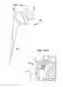 Fig. 14 - Pneumatic surgical instrument and corresponding methods for implanting, extracting and reorienting orthopedic implants