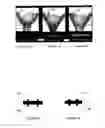Fig. 02 - ELECTRICAL STIMULATION OF THE CERVIX