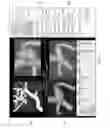 Fig. 10 - BLOODSTREAM SIMULATION SYSTEM FOR SIMULATING BLOOD VESSEL TREATMENT EFFECT, METHOD THEREFOR, AND COMPUTER SOFTWARE PROGRAM