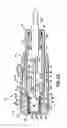 Fig. 10 - Cam-actuated medical puncturing device and method