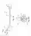 Fig. 07 - Implant recovery device
