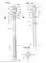 Fig. 02 - Minimally invasive spinal facet compression screw and system for bone joint fusion and fixation