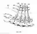 Fig. 05 - Bone screw of minimally invasive fixation device for lumbar