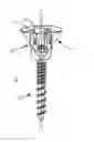 Fig. 01 - Spinal correction system and method