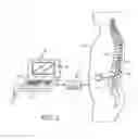Fig. 03 - Systems and methods for delivering sub-threshold therapy to a patient at a physiological midline