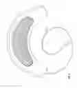 Fig. 09 - Shapeable light therapy device and method