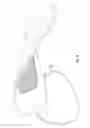 Fig. 10 - Shapeable light therapy device and method