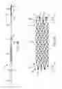 Fig. 05 - PROSTHESIS AND DELIVERY SYSTEM