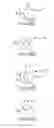 Fig. 23 - PROSTHESIS AND DELIVERY SYSTEM