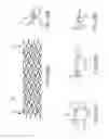 Fig. 33 - PROSTHESIS AND DELIVERY SYSTEM
