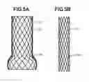 Fig. 06 - Stent graft