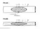 Fig. 07 - Stent graft