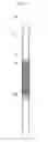 Fig. 06 - METHOD OF MANUFACTURING STENT ATTACHED TO ARTIFICIAL BLOOD VESSEL AND STENT ATTACHED TO ARTIFICIAL BLOOD VESSEL MANUFACTURED BY THE SAME