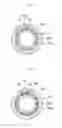 Fig. 19 - METHOD OF MANUFACTURING STENT ATTACHED TO ARTIFICIAL BLOOD VESSEL AND STENT ATTACHED TO ARTIFICIAL BLOOD VESSEL MANUFACTURED BY THE SAME