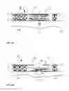 Fig. 07 - Device for soft tissue support and method for anchoring
