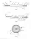 Fig. 10 - Catheter system for introducing an expandable heart valve stent into the body of a patient