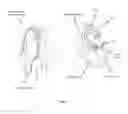 Fig. 11 - Catheter system for introducing an expandable heart valve stent into the body of a patient