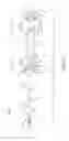 Fig. 14 - Catheter system for introducing an expandable heart valve stent into the body of a patient