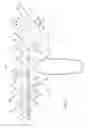 Fig. 21 - Catheter system for introducing an expandable heart valve stent into the body of a patient