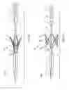 Fig. 25 - Catheter system for introducing an expandable heart valve stent into the body of a patient