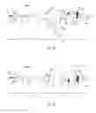 Fig. 27 - Catheter system for introducing an expandable heart valve stent into the body of a patient