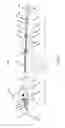 Fig. 33 - Catheter system for introducing an expandable heart valve stent into the body of a patient