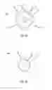 Fig. 35 - Catheter system for introducing an expandable heart valve stent into the body of a patient