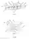 Fig. 37 - Catheter system for introducing an expandable heart valve stent into the body of a patient