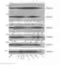 Fig. 40 - Catheter system for introducing an expandable heart valve stent into the body of a patient