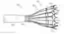 Fig. 01 - Systems and methods for delivering a medical implant