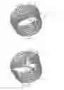 Fig. 04 - Systems and methods for delivering a medical implant