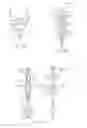 Fig. 05 - Systems and methods for delivering a medical implant