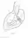 Fig. 06 - Systems and methods for delivering a medical implant
