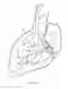Fig. 07 - Systems and methods for delivering a medical implant