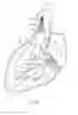 Fig. 08 - Systems and methods for delivering a medical implant