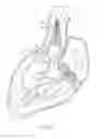 Fig. 09 - Systems and methods for delivering a medical implant