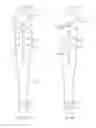 Fig. 22 - Systems and methods for delivering a medical implant