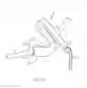 Fig. 46 - Systems and methods for delivering a medical implant