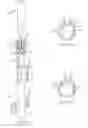 Fig. 57 - Systems and methods for delivering a medical implant