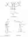 Fig. 65 - Systems and methods for delivering a medical implant