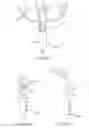 Fig. 67 - Systems and methods for delivering a medical implant