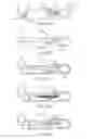 Fig. 68 - Systems and methods for delivering a medical implant