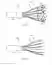 Fig. 77 - Systems and methods for delivering a medical implant
