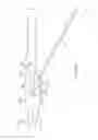 Fig. 85 - Systems and methods for delivering a medical implant
