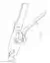 Fig. 86 - Systems and methods for delivering a medical implant